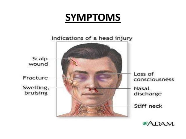 Head Fall Crown Of Head Injury Symptoms: Open Head Injury – SMZWL
