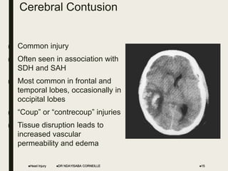 Cerebral Contusion
■ Common injury
■ Often seen in association with
SDH and SAH
■ Most common in frontal and
temporal lobes, occasionally in
occipital lobes
■ “Coup” or “contrecoup” injuries
■ Tissue disruption leads to
increased vascular
permeability and edema
Head Injury 15
DR NDAYISABA CORNEILLE
 