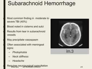 Subarachnoid Hemorrhage
■ Most common finding in moderate to
severe TBI (40%)
■ Blood noted in cisterns and sulci
■ Results from tear in subarachnoid
vessels
■ May precipitate vasospasm
■ Often associated with meningeal
signs:
– Photophobia
– Neck stiffness
– Headache
■ Requires neurosurgical consultation
Head Injury 18
DR NDAYISABA CORNEILLE
 