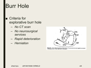 Burr Hole
■ Criteria for
explorative burr hole
– No CT scan
– No neurosurgical
services
– Rapid deterioration
– Herniation
Head Injury 38
DR NDAYISABA CORNEILLE
 