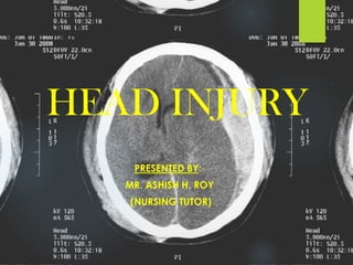 HEAD INJURY
PRESENTED BY:-
MR. ASHISH H. ROY
(NURSING TUTOR)
 