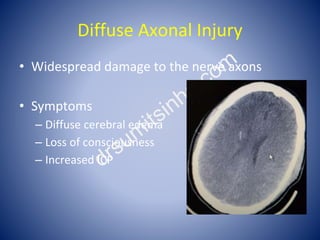 Head injury by Dr. sumit sinha | PPTX