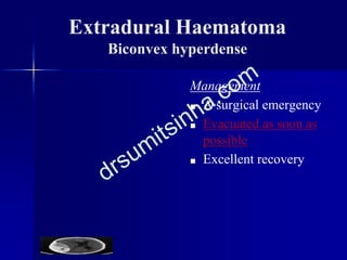 Extradural Haematoma
Biconvex hyperdense
Management
■ A surgical emergency
■ Evacuated as soon as
possible
■ Excellent recovery
 