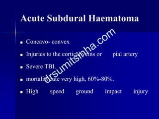 Acute Subdural Haematoma
 