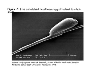 Head Lice.ppt