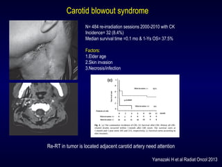 N= 484 re-irradiation sessions 2000-2010 with CK
Incidence= 32 (8.4%)
Median survival time =0.1 mo & 1-Ys OS= 37.5%
Factors:
1.Elder age
2.Skin invasion
3.Necrosis/infection
Carotid blowout syndrome
Re-RT in tumor is located adjacent carotid artery need attention
Yamazaki H et al Radiat Oncol 2013
 