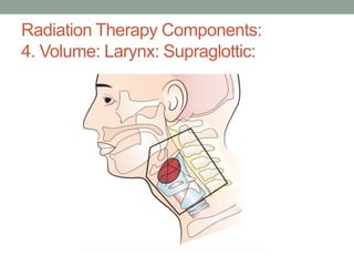 Radiation Therapy Components:
4. Volume: Larynx: Supraglottic:
 