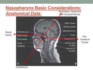 Nasopharynx Basic Considerations:
Anatomical Data:
Skull Base: Sphenoid
and Occipital Bones
Pre-
Vertebral
Fascia
Nasal
Cavity
Oropharynx
 
