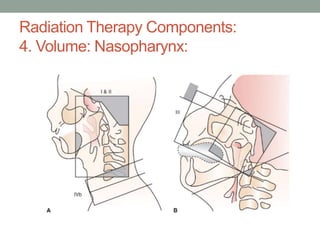 Radiation Therapy Components:
4. Volume: Nasopharynx:
 