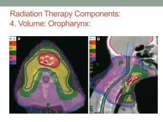 Radiation Therapy Components:
4. Volume: Oropharynx:
 