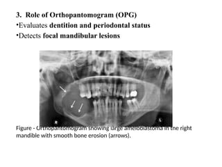 Opg Infection Comprehensive Head and Neck Imaging Techniques in Oncology | PPTX