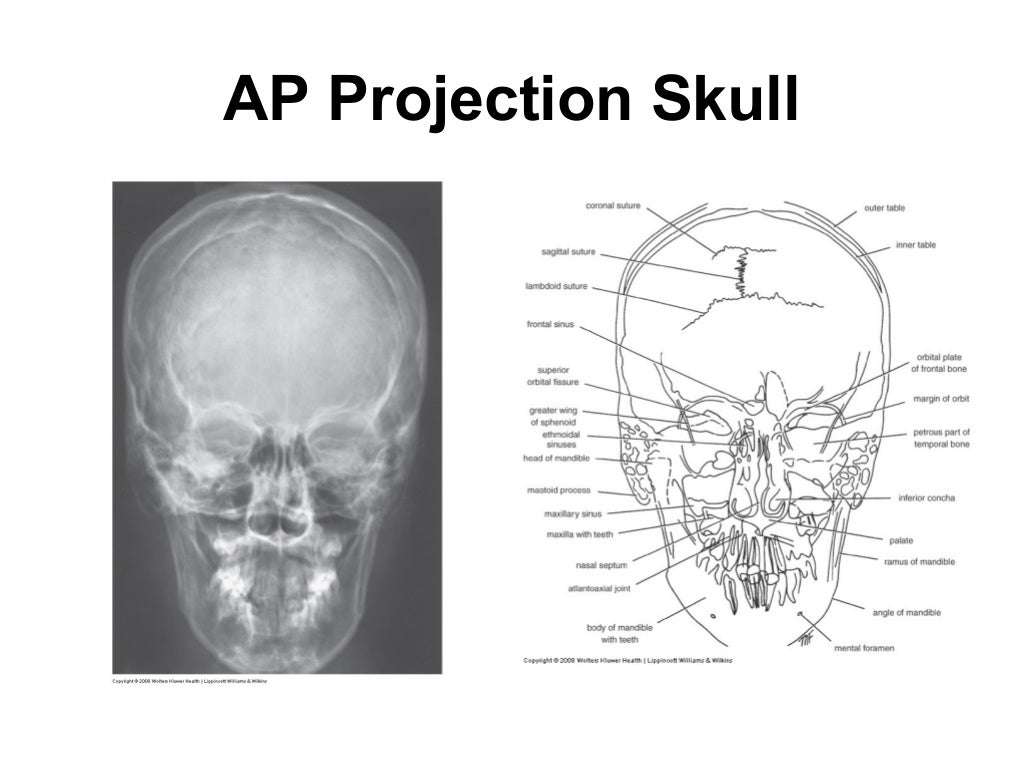 Head &amp; neck rs x-rays