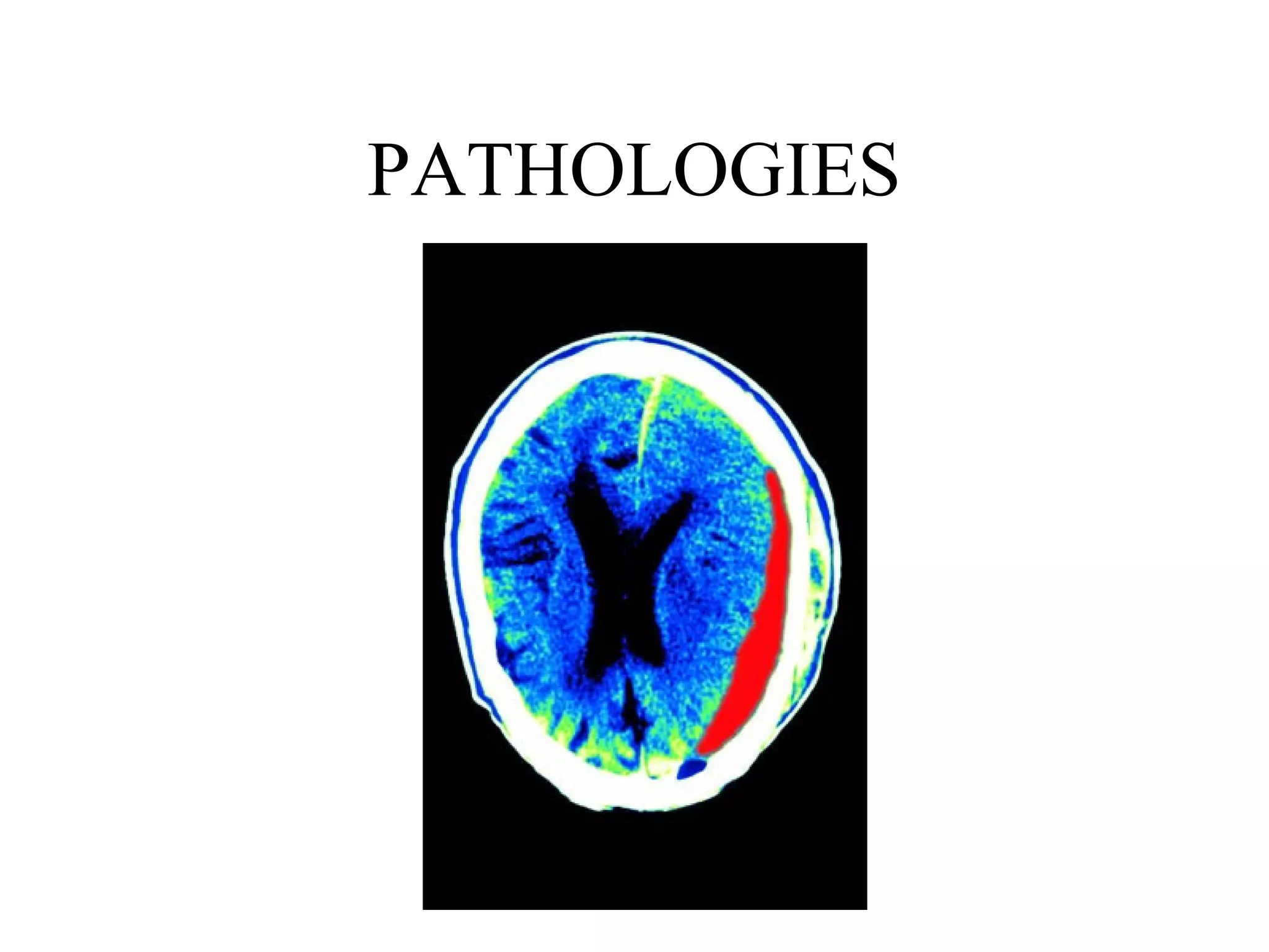 PATHOLOGIES

www.indiandentalacademy.com

 