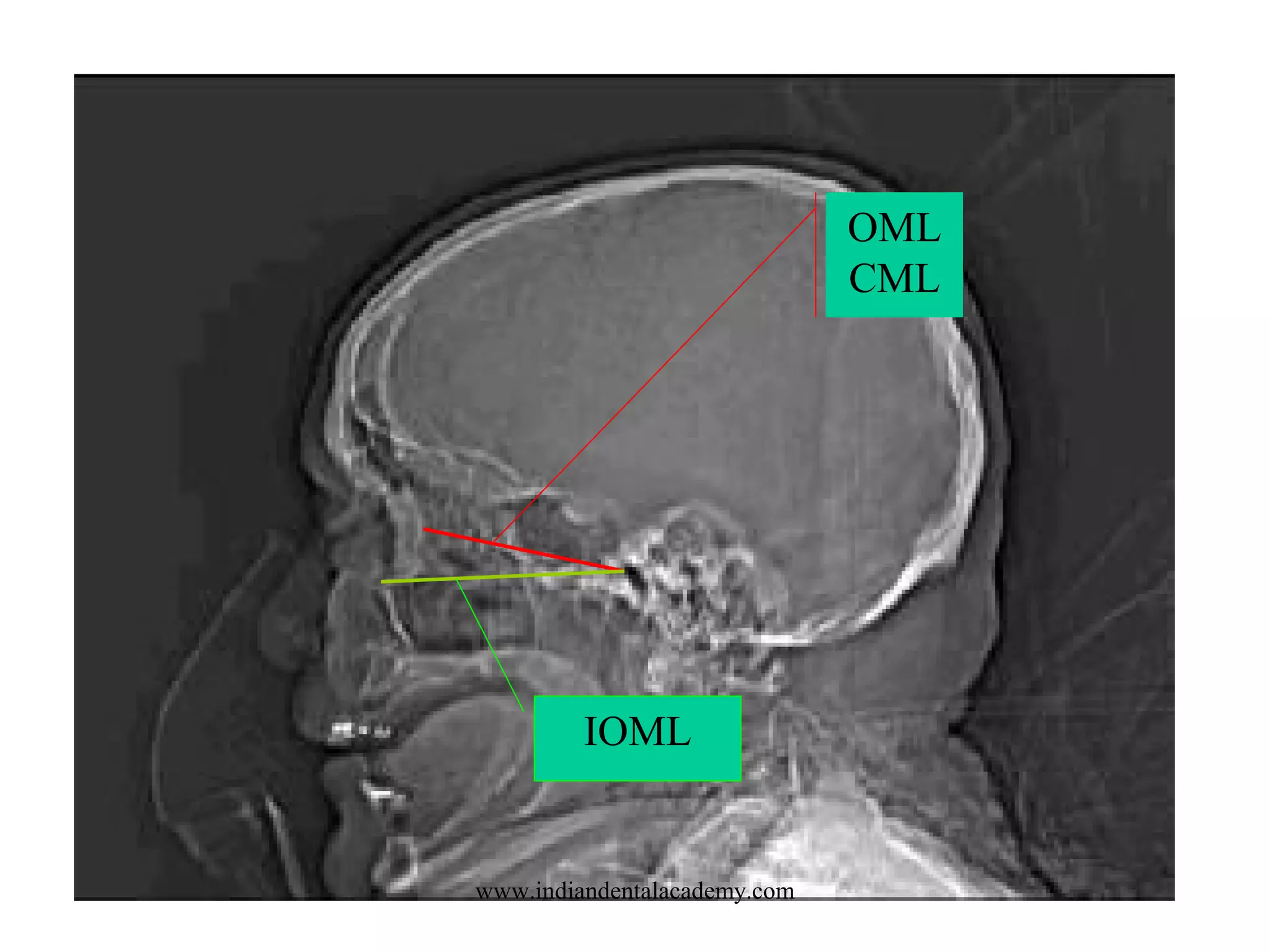 OML
CML

IOML

www.indiandentalacademy.com

 