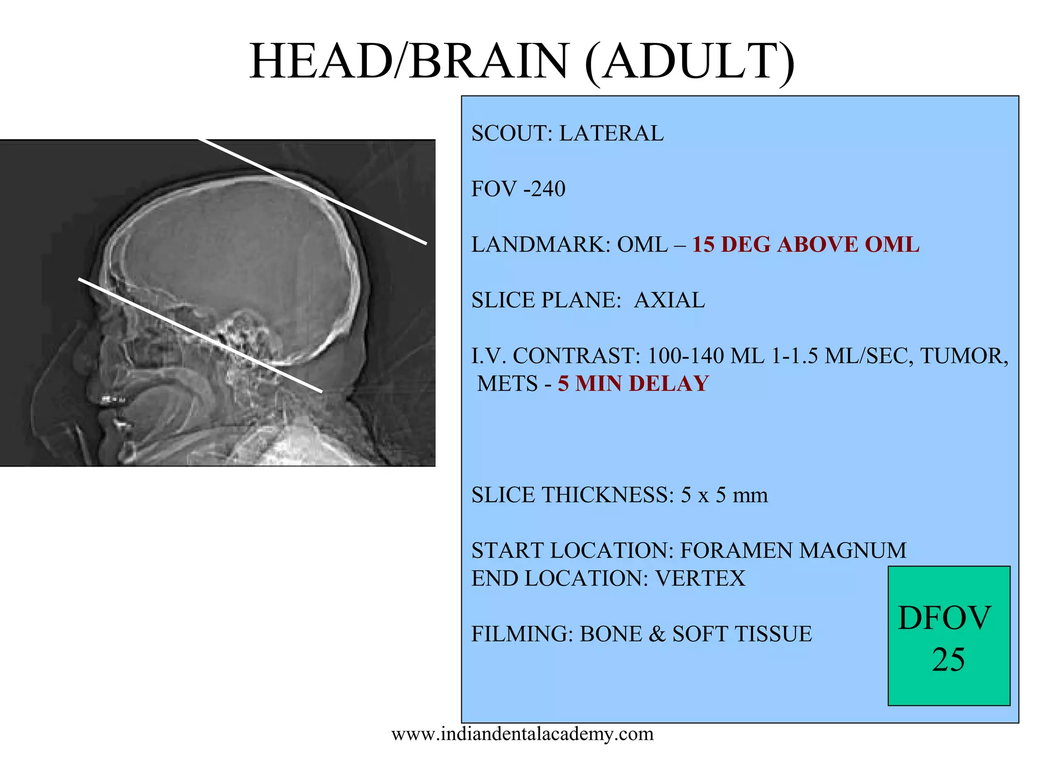 HEAD/BRAIN (ADULT)
SCOUT: LATERAL
FOV -240
LANDMARK: OML – 15 DEG ABOVE OML
SLICE PLANE: AXIAL
I.V. CONTRAST: 100-140 ML 1-1.5 ML/SEC, TUMOR,
METS - 5 MIN DELAY

SLICE THICKNESS: 5 x 5 mm
START LOCATION: FORAMEN MAGNUM
END LOCATION: VERTEX
FILMING: BONE & SOFT TISSUE

www.indiandentalacademy.com

DFOV
25

 