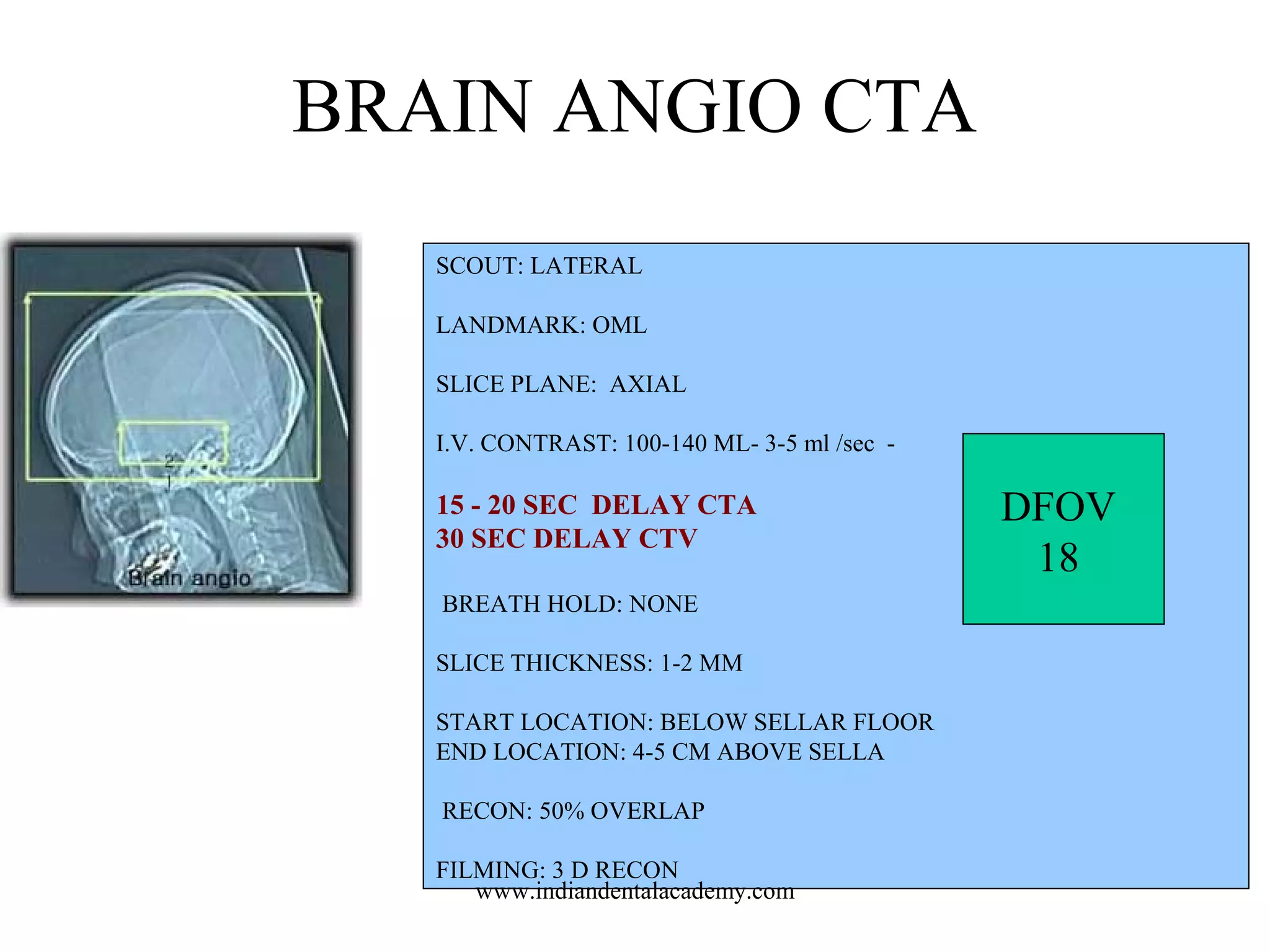 BRAIN ANGIO CTA
SCOUT: LATERAL
LANDMARK: OML
SLICE PLANE: AXIAL
I.V. CONTRAST: 100-140 ML- 3-5 ml /sec -

15 - 20 SEC DELAY CTA
30 SEC DELAY CTV
BREATH HOLD: NONE
SLICE THICKNESS: 1-2 MM
START LOCATION: BELOW SELLAR FLOOR
END LOCATION: 4-5 CM ABOVE SELLA
RECON: 50% OVERLAP
FILMING: 3 D RECON
www.indiandentalacademy.com

DFOV
18

 