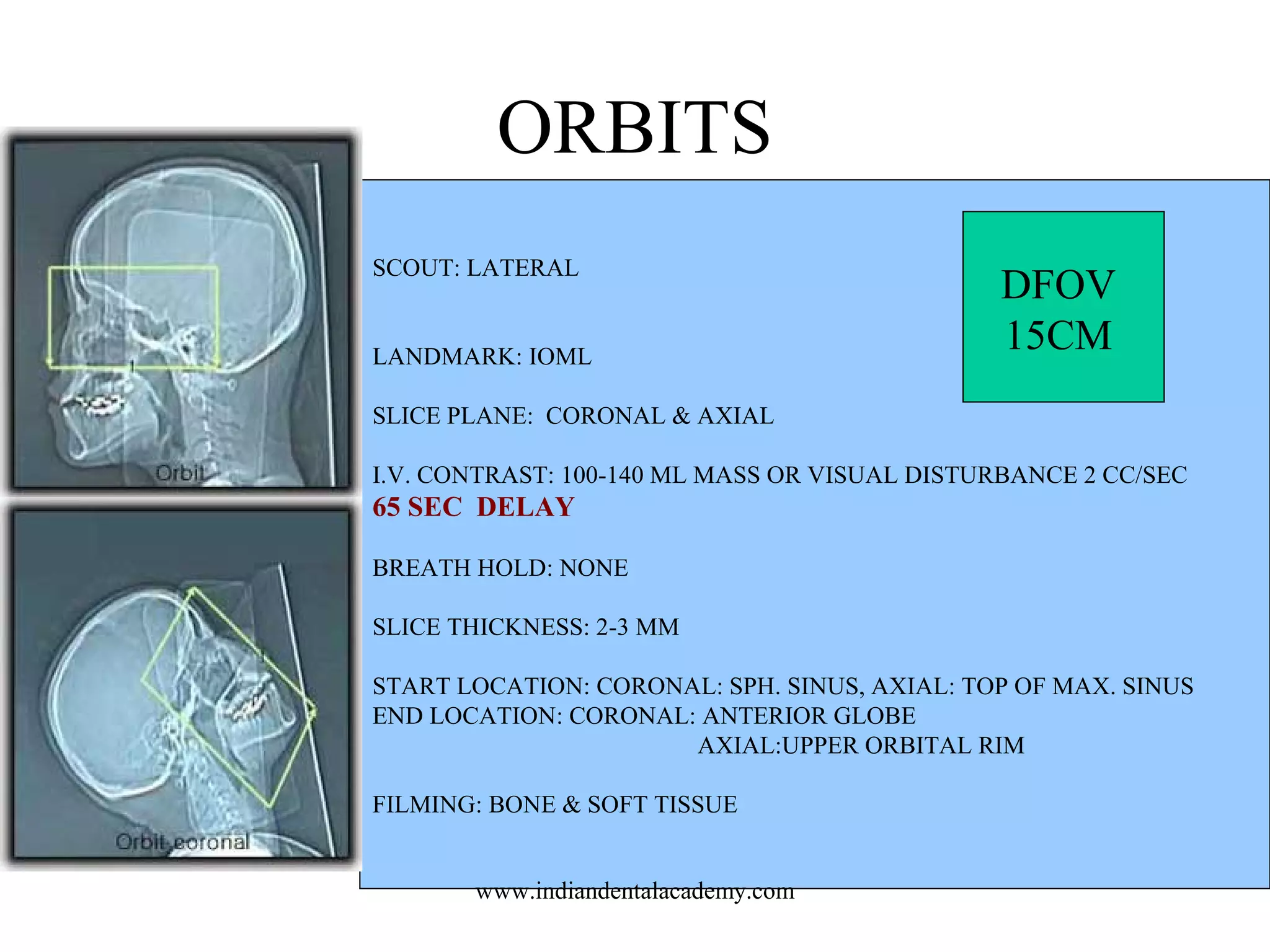 ORBITS
SCOUT: LATERAL
LANDMARK: IOML

DFOV
15CM

SLICE PLANE: CORONAL & AXIAL
I.V. CONTRAST: 100-140 ML MASS OR VISUAL DISTURBANCE 2 CC/SEC

65 SEC DELAY
BREATH HOLD: NONE
SLICE THICKNESS: 2-3 MM
START LOCATION: CORONAL: SPH. SINUS, AXIAL: TOP OF MAX. SINUS
END LOCATION: CORONAL: ANTERIOR GLOBE
AXIAL:UPPER ORBITAL RIM
FILMING: BONE & SOFT TISSUE
www.indiandentalacademy.com

 