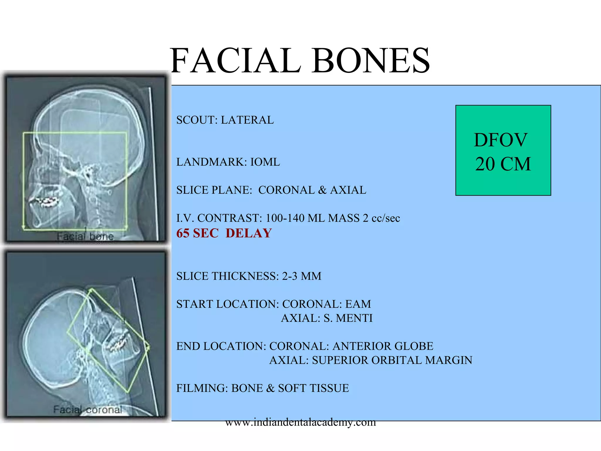 FACIAL BONES
SCOUT: LATERAL
LANDMARK: IOML
SLICE PLANE: CORONAL & AXIAL
I.V. CONTRAST: 100-140 ML MASS 2 cc/sec

65 SEC DELAY
SLICE THICKNESS: 2-3 MM
START LOCATION: CORONAL: EAM
AXIAL: S. MENTI
END LOCATION: CORONAL: ANTERIOR GLOBE
AXIAL: SUPERIOR ORBITAL MARGIN
FILMING: BONE & SOFT TISSUE
www.indiandentalacademy.com

DFOV
20 CM

 