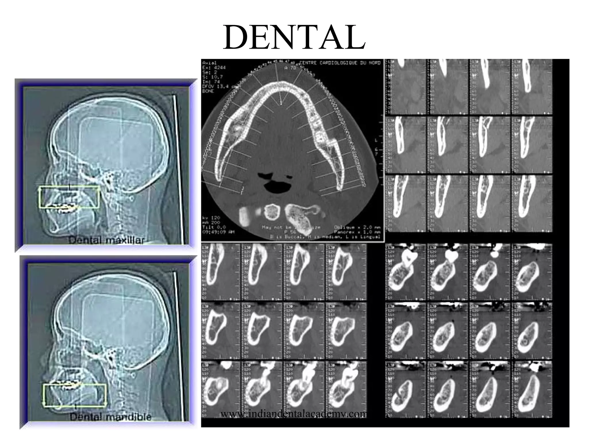 DENTAL

www.indiandentalacademy.com

 
