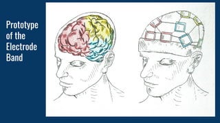 Prototype
of the
Electrode
Band
 