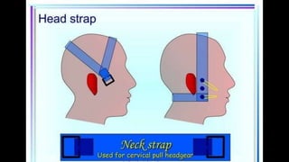 HEAD STRAP.pptx