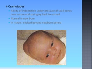 Head to foot examination in Paediatrics | PPTX