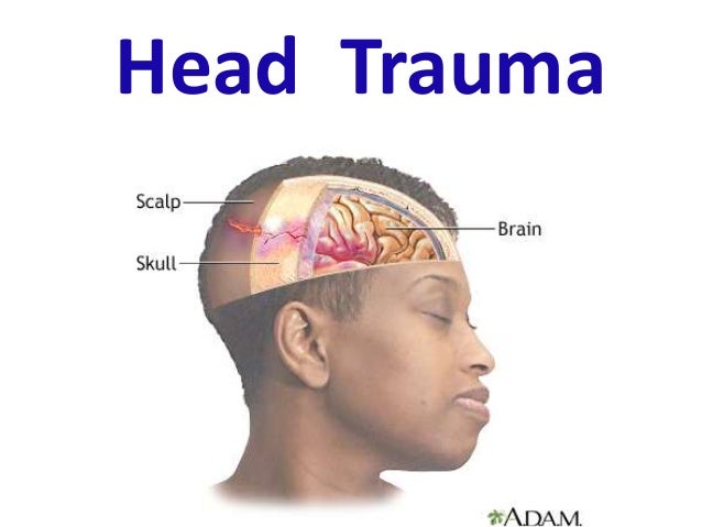 Head trauma diagram of side of face 