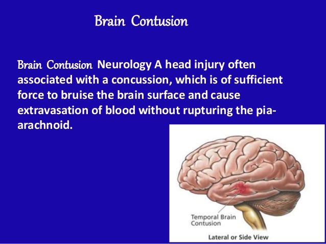 dizziness vomiting unequal pupil size and shock
