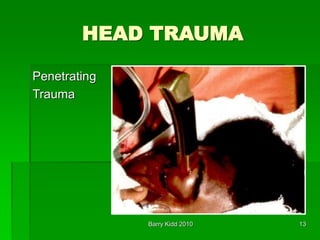 Barry Kidd 2010 13
HEAD TRAUMA
Penetrating
Trauma
 