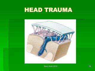 Barry Kidd 2010 18
HEAD TRAUMA
 
