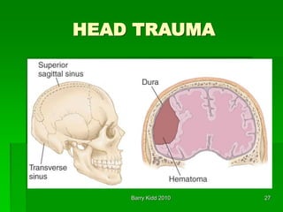 Barry Kidd 2010 27
HEAD TRAUMA
 