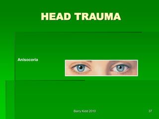 Barry Kidd 2010 37
HEAD TRAUMA
Anisocoria
 