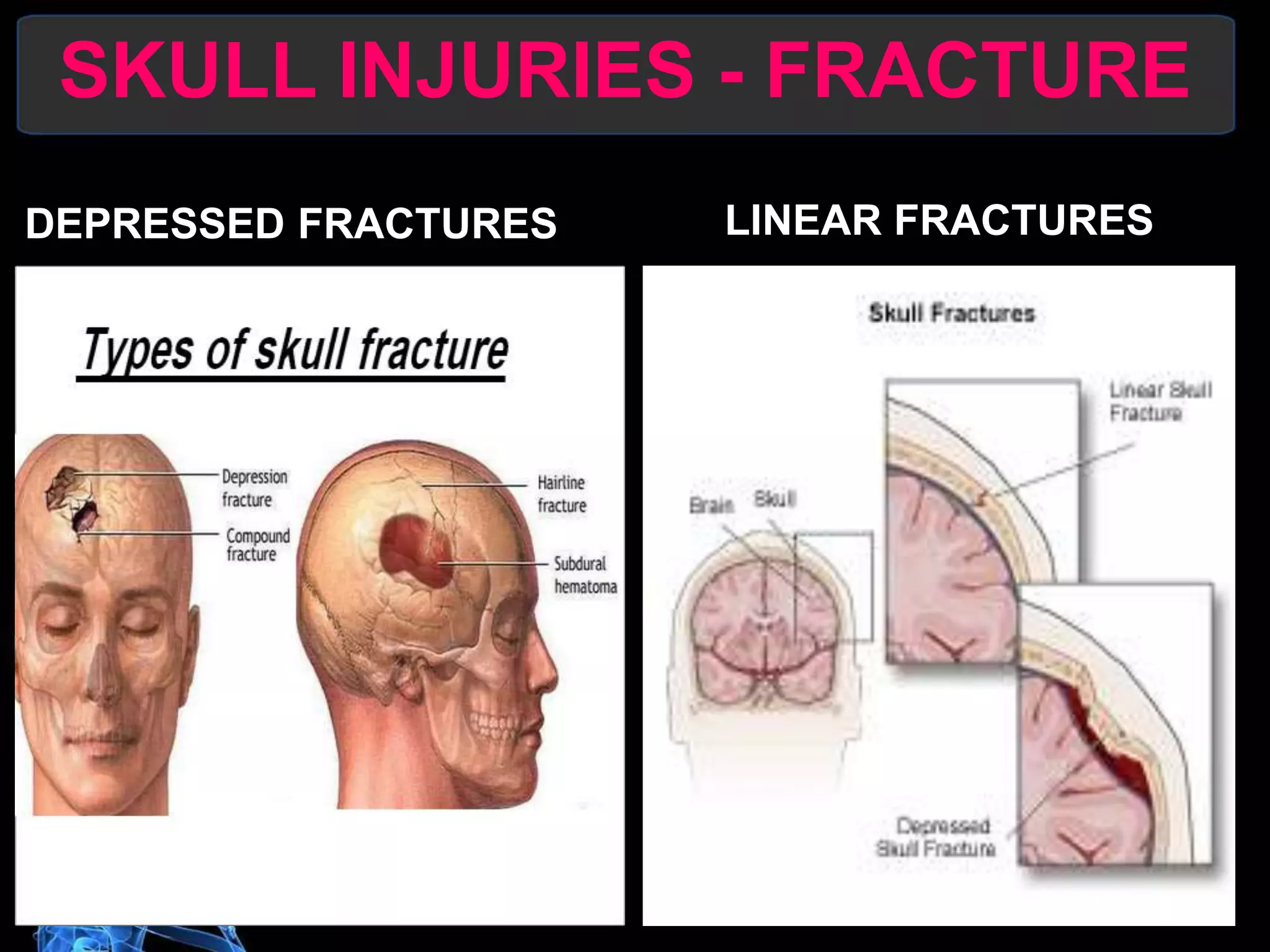 HEAD TRAUMA & CEREBRAL RESUSCITATION copy.pptx