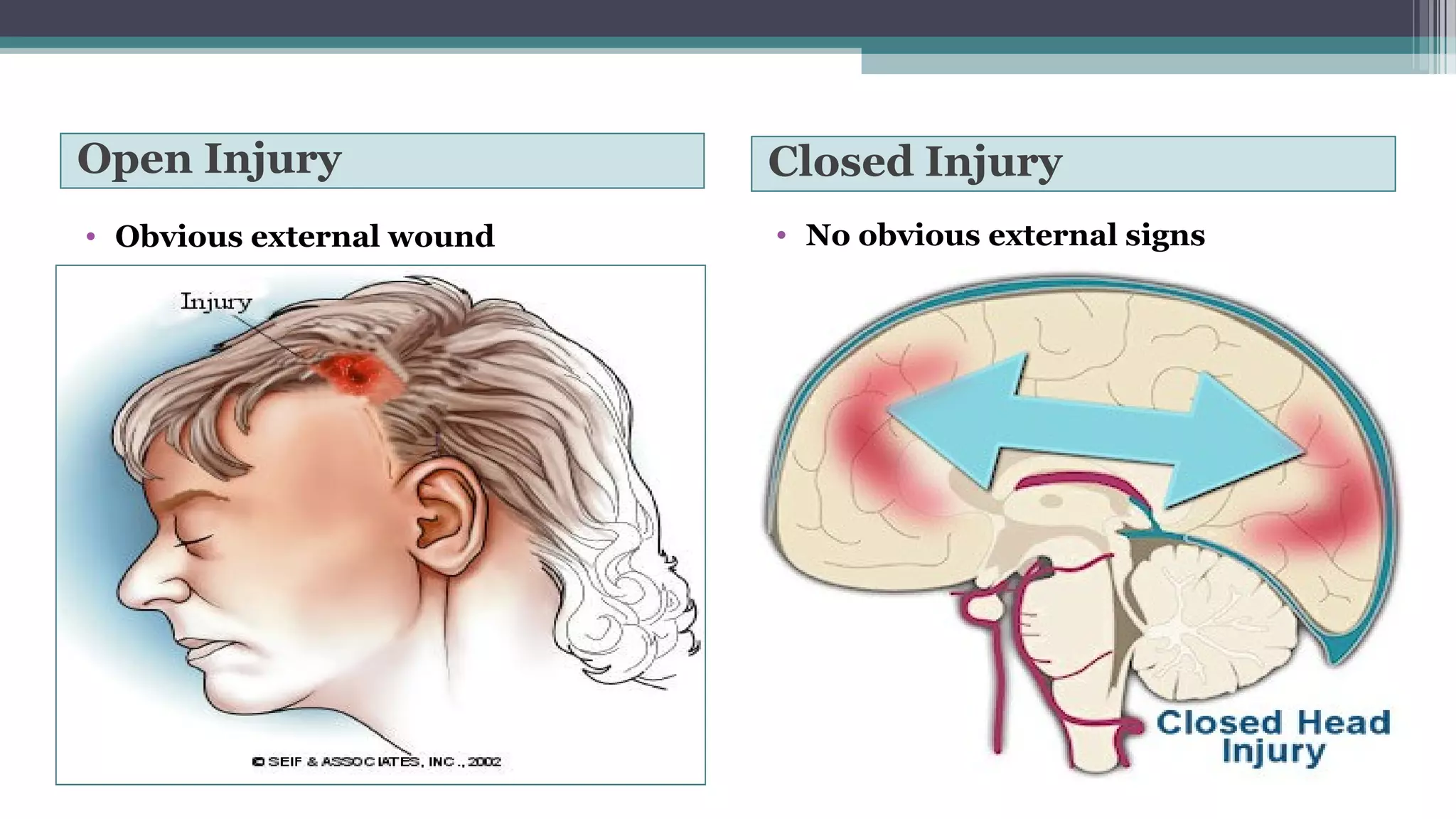 Simple Open Injuries Head trauma & Management | PPT