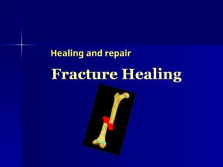 Fracture Healing
Healing and repair
 