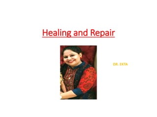 Healing and Repair
DR. EKTA
 