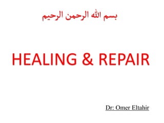 HEALING & REPAIR
‫الرحيم‬‫الرحمن‬‫هللا‬‫بسم‬
Dr: Omer Eltahir
 