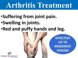 Arthritis Treatment
•Suffering from joint pain.
•Swelling in joints.
•Red and puffy hands and leg.
EFFECTIVE
UP TO
MODERATE
DISEASE
 