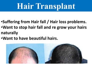 Hair Transplant
•Suffering from Hair fall / Hair loss problems.
•Want to stop hair fall and re grow your hairs
naturally
•Want to have beautiful hairs.
 