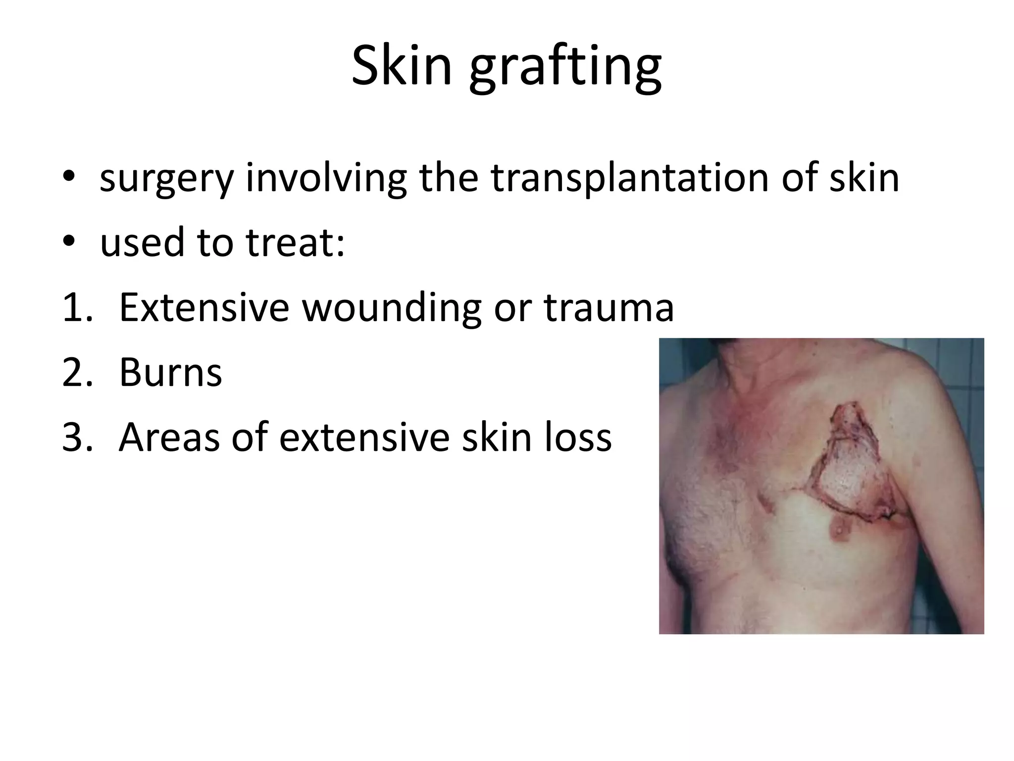 Skin grafting
• surgery involving the transplantation of skin
• used to treat:
1. Extensive wounding or trauma
2. Burns
3. Areas of extensive skin loss
 