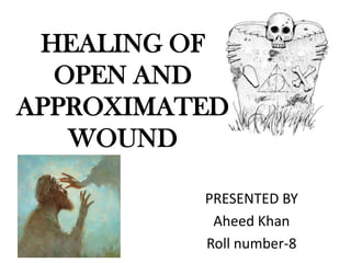HEALING OF
  OPEN AND
APPROXIMATED
   WOUND

          PRESENTED BY
           Aheed Khan
          Roll number-8
 