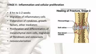 STAGE II : Inflammation and cellular proliferation
• 8 hrs to 1-2 weeks
• Migration of inflammatory cells
• Elaboration of cytokines, growth
factors, other mediators
• Proliferation and differentiation of
mesenchymal stem cells, migration
of fibroblasts and osteoclasts
• neovascularization
 