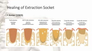 Healing of Extraction Socket
• Amler (1969)
 