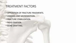 TREATMENT FACTORS
• APPOSITION OF FRACTURE FRAGMENTS.
• LOADING AND MICROMOTION .
• FRACTURE STABILIZATION.
• RIGID FIXATION.
• BONE GRAFTING.
 