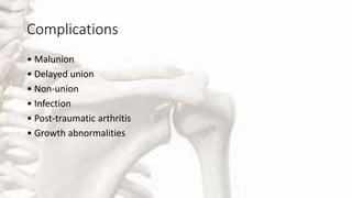 Complications
• Malunion
• Delayed union
• Non-union
• Infection
• Post-traumatic arthritis
• Growth abnormalities
 