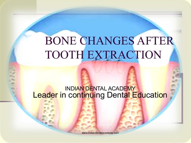 bone spicules after tooth extraction