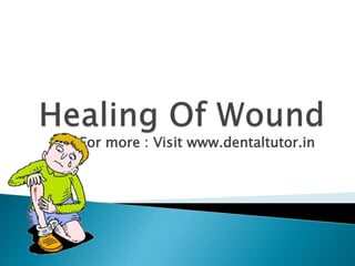 For more : Visit www.dentaltutor.in
 