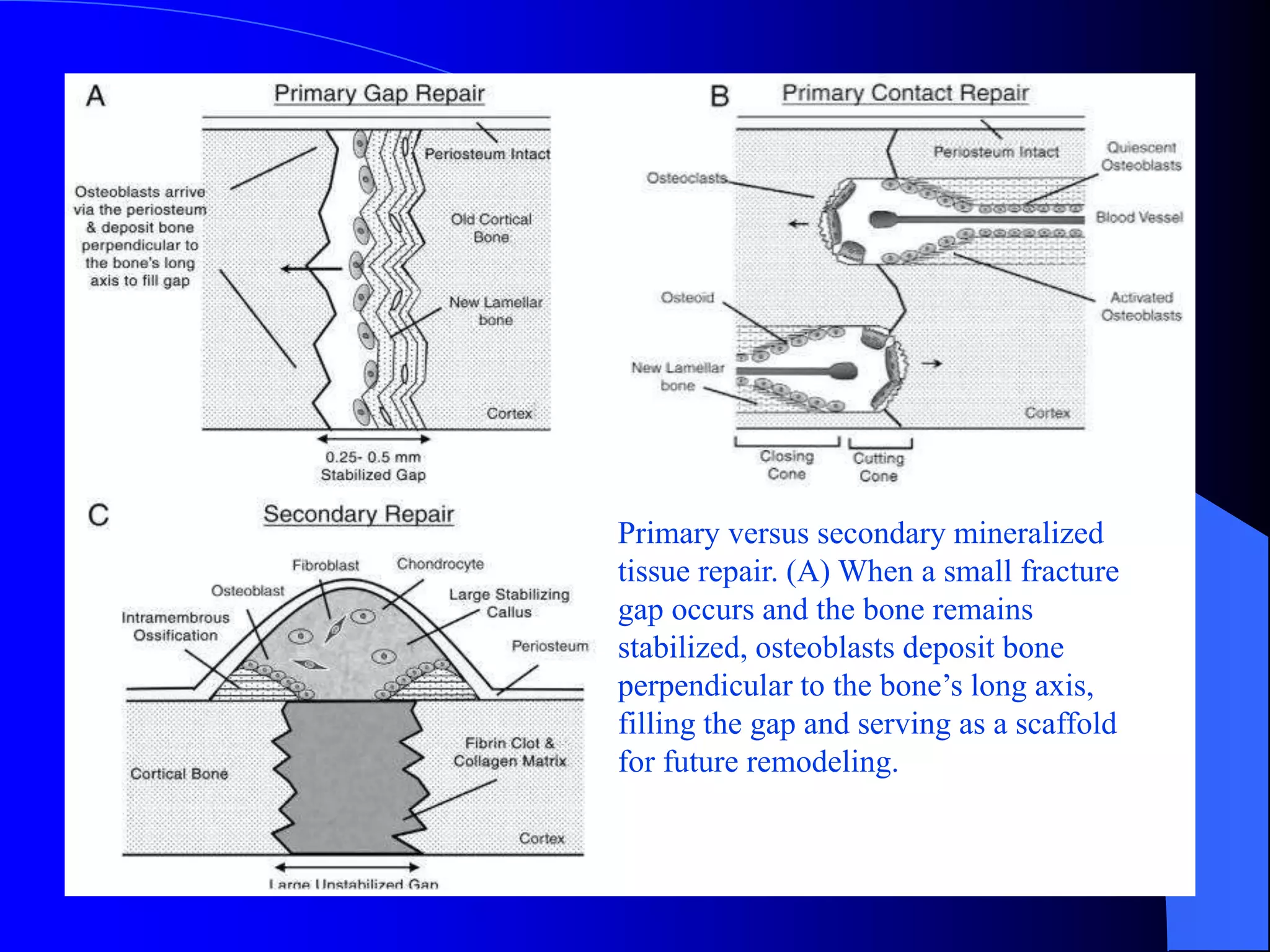 Pathology of Healing & repair | PPTX