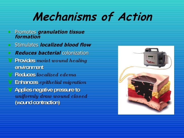 Healing The Wound The Vac System In Woundcare