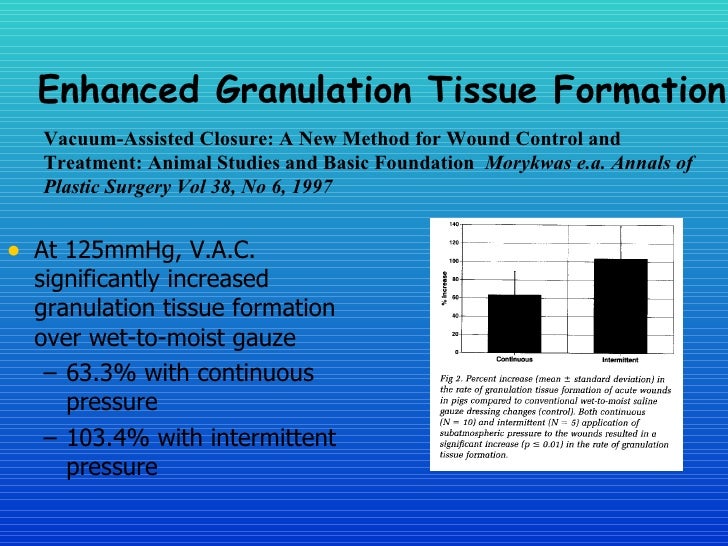 Healing The Wound The Vac System In Woundcare